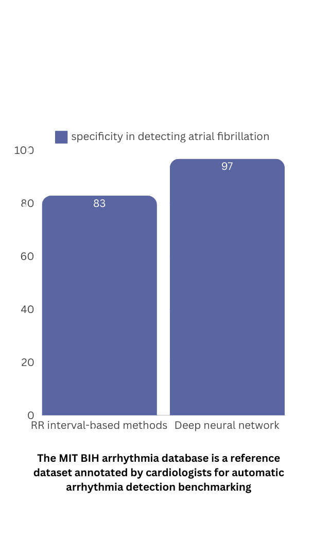 Automatic arrhythmia detection superiority